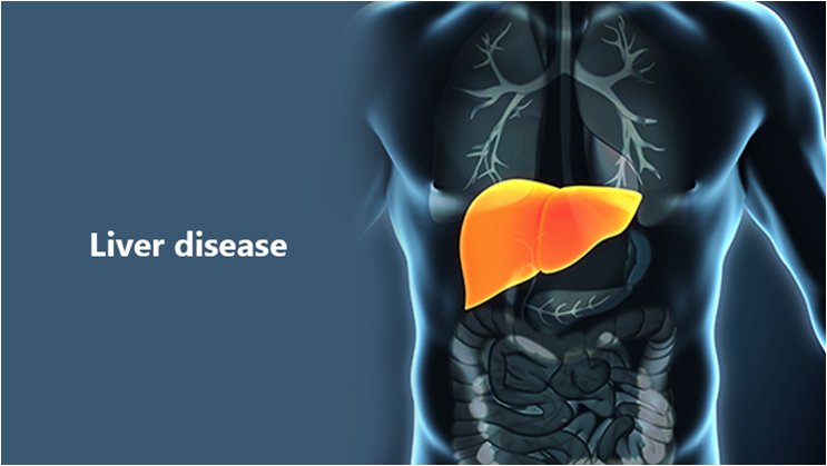 Giant leap in diagnosing liver disease - Healthcare Channel